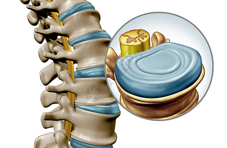 背部脊椎腰椎盘解剖节段医学,人体背部骨骼的特写,脊椎放大,脊髓椎间盘三维插图分离白色背景