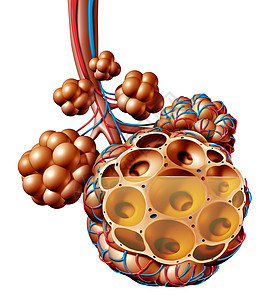 肺炎肺泡与液体肺泡炎症解剖图个医学的肺解剖呼吸医学个三维插图隔离白色背景图片