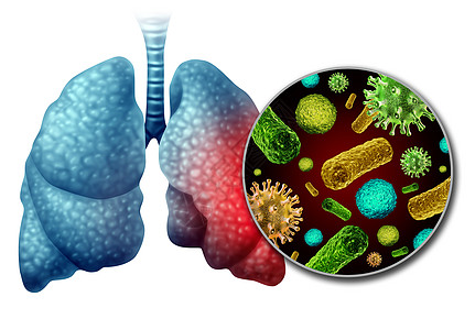 肺炎感染解剖学种医学,人类肺部感染病细菌的炎症,种肺部疾病的诊断与三维插图元素背景图片