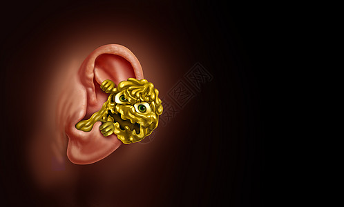 耳蜡听力损失,由于耳蜡堵塞内部解剖,种恶心的怪物蜡质与三维插图元素背景图片
