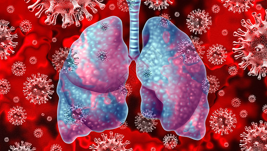 呼吸道病冠状病爆发冠状病流感背景危险流感菌株病例SARS大流行的医疗健康风险,以感染的人肺三维渲染图片