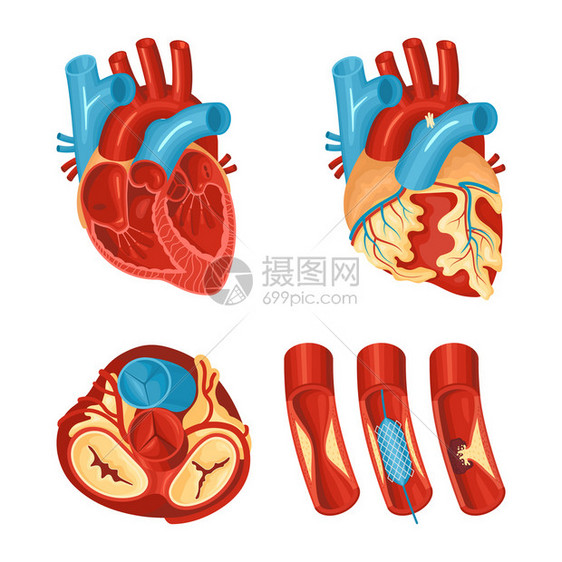 白色背景矢量插图上分离的健康疾病的心脏平集的解剖图片