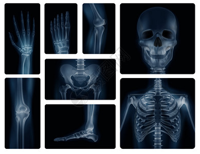 颅骨骨盆胸部膝盖四肢的真实X线照片人体骨骼真实的拍摄背景图片