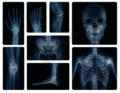 颅骨骨盆胸部膝盖四肢的真实X线照片人体骨骼真实的拍摄图片