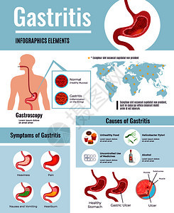 胃炎症状胃溃疡引的信息健康的食物惯世界人口影响信息图片海报矢量插图图片