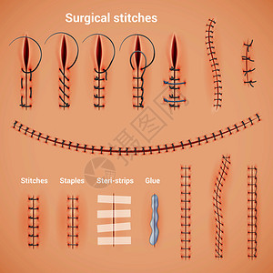金针菇串插画_金针菇串卡通_金针菇串插图_手绘_板绘_摄图网