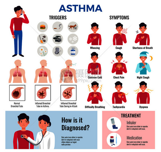 哮喘慢疾病平信息图元素收集与触发症状,导致诊断,药物治疗矢量插图图片