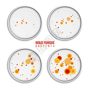 霉菌细菌菌落集四个真实的图像与圆形框架,彩色点文本矢量插图图片