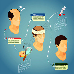 头发移植等距矢量插图与描述手术程序恢复头发秃头毛发移植载体插图图片