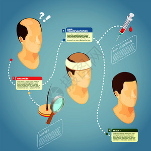 头发移植等距矢量插图与描述手术程序恢复头发秃头毛发移植载体插图背景图片
