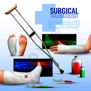 外科创伤学的现实与手足腿部损伤符号矢量插图外科创伤学的图片
