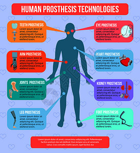 人类医学原型现代技术平信息画海报与集成植入机器人手臂人工关节矢量插图人类原型技术信息图片