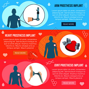 医学假体植入技术3平水平彩色背景网站横幅与人工四肢矢量插图假体平横幅图片