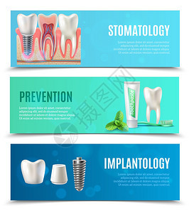 种植牙3个水平横幅医疗口腔保健3个水平横幅预防口腔科牙种植体书签孤立矢量插图背景图片