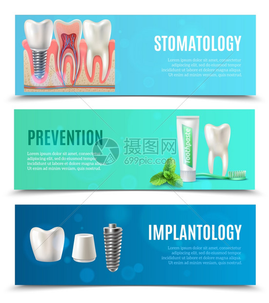 种植牙3个水平横幅医疗口腔保健3个水平横幅预防口腔科牙种植体书签孤立矢量插图图片