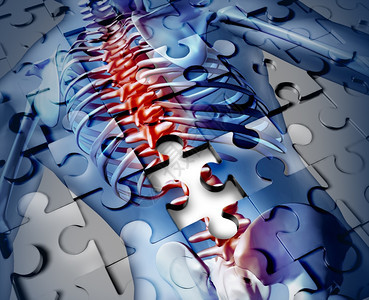 人类后背疾病医学概念有拼图纹理和一块骨骼解剖残缺的碎片以及因发炎引起的脊椎和共同疼痛的象征背景图片