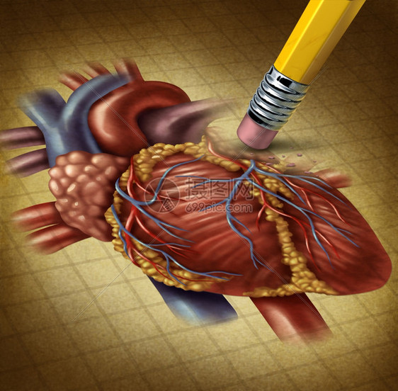 人体心脏健康受损血液循环减少给心血管系统造成问题因为用铅笔擦拭器在纸上抹去一个老旧的外壳医学插图图片
