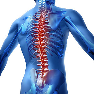 背部和疼痛身体骨骼上部躯显示脊椎和柱红色亮点作为脊椎外科和白底治疗的医保健概念背景图片