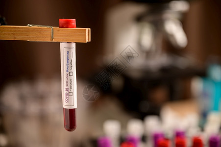 实验室内共生19的血液样本测试管图片