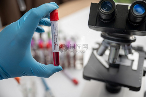 医疗设备在化验室进行血液抽样测试图片