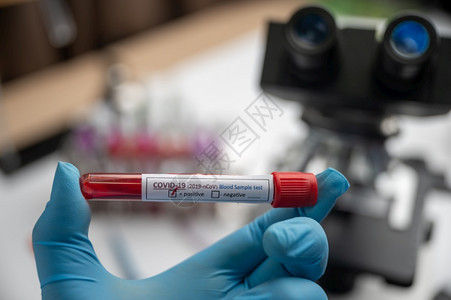 含有血液样本的冠状covid19管的存在血样测试本该血已经检测出冠状呈阳图片