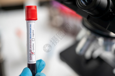 含有血液样本的冠状covid19管的存在血样测试本该血已经检测出冠状呈阳图片
