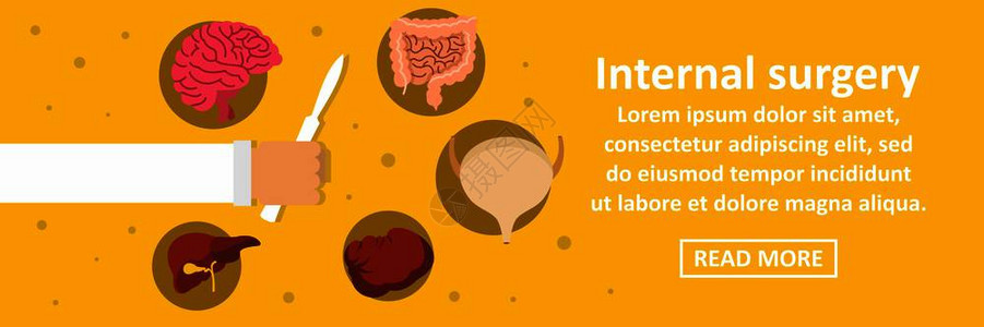 内部外科横幅向概念内部外科横幅向概念图片