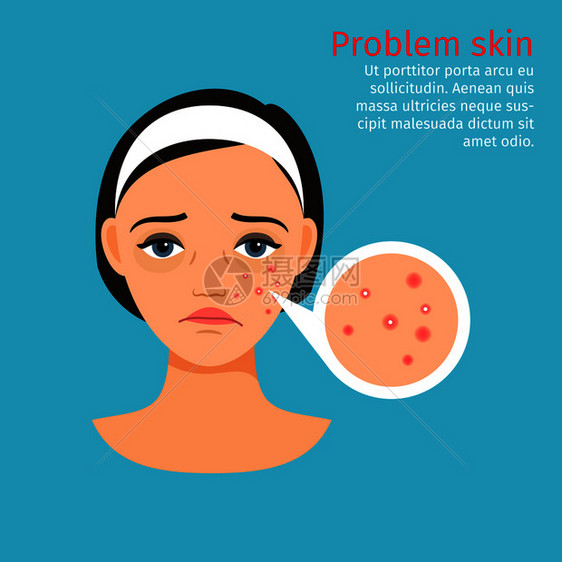 妇女面临有问题皮肤的丙烯矢量说明妇女面临有问题皮肤的丙烯图片