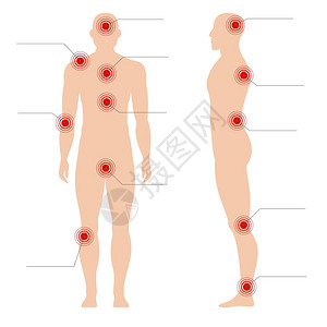 身体按摩人类双影矢量医疗抽象图示上的痛苦红色点带有疼痛的人体类双影矢量医疗抽象图示上的痛苦红色点图示上的痛苦红色点图示上的痛苦红色点图示插画