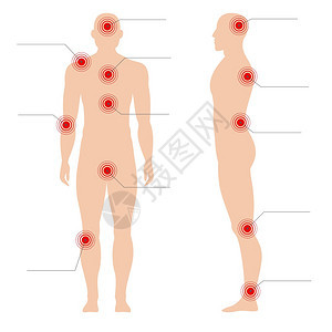 人类双影矢量医疗抽象图示上的痛苦红色点带有疼痛的人体类双影矢量医疗抽象图示上的痛苦红色点图示上的痛苦红色点图示上的痛苦红色点图示图片