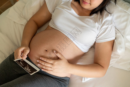 孕期护理图片