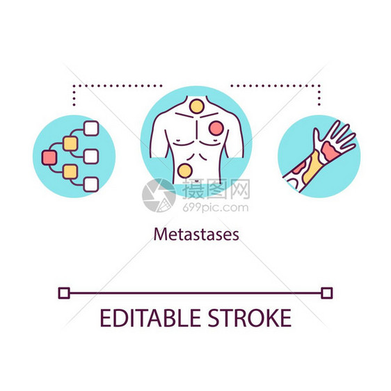 肿瘤扩散癌症细胞传播病媒孤立的大纲rgb彩色图画可编辑的中风图片