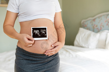 孕妇与婴儿B超照图片