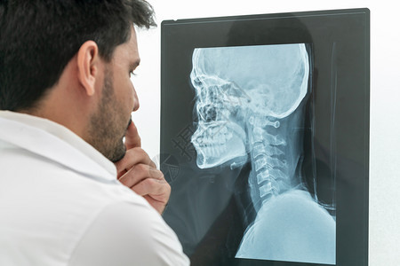 负责医院头部或脑疾病x光片的年轻男医生图片
