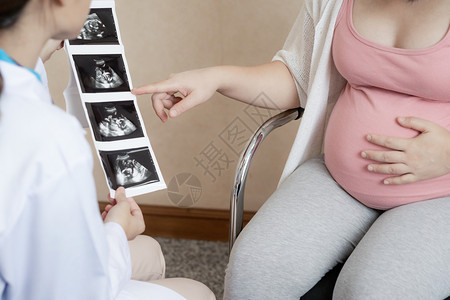 医生进行母婴保健检查图片