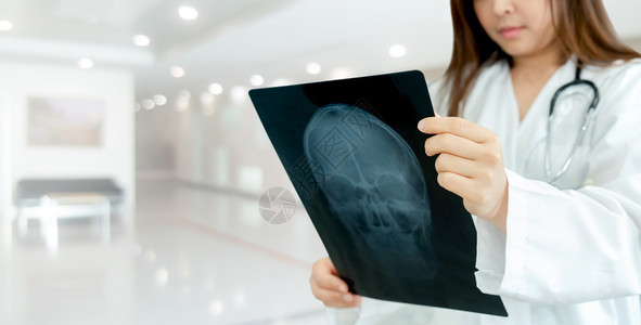 女医生在检查病人的x光图象图片