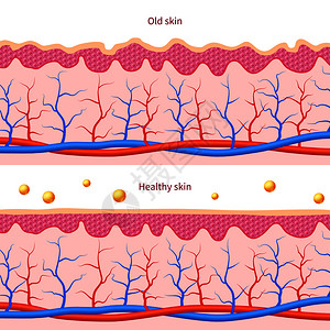 皮肤弹性皮肤图层人类体影响健康病媒图层插画