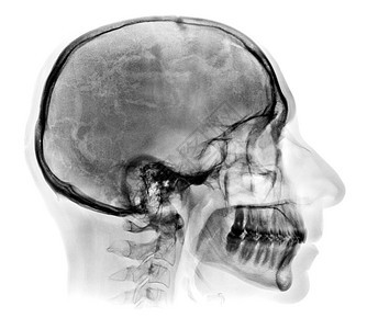 白色上隔离的人体头骨X光图像图片