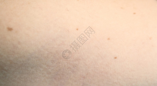 人类皮肤上的大熊星座背景图片
