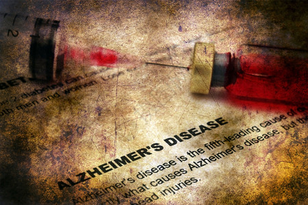 阿尔茨海默病后遗症概念图片