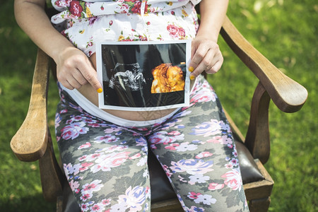 孕妇在花园展示彩超照片图片