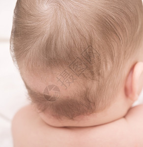 婴儿斑秃特写图片