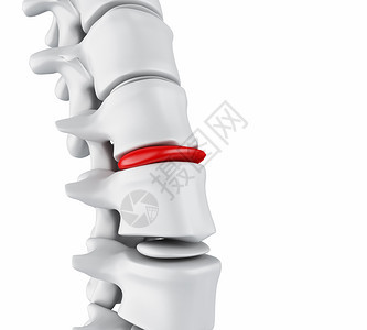 3d插图骨骼结构和间脊椎盘的闭合嵌入磁盘概念图片