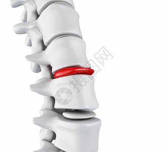 3d插图骨骼结构和间脊椎盘的闭合嵌入磁盘概念背景图片