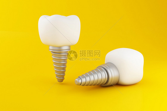 3d说明在黄色背景上植入牙科齿护理概念图片