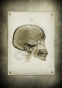 黑色旧纸背景的X光头骨图像旧纸背景的X光头骨图像图片