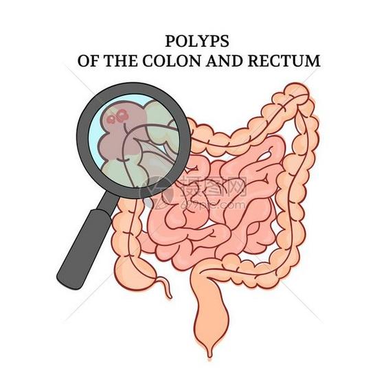 结肠医学解剖 图片