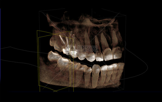 3d可视化计算机缩写图的直映图片