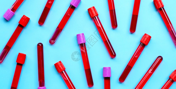 蓝色背景的血液测试管中顶部视图图片
