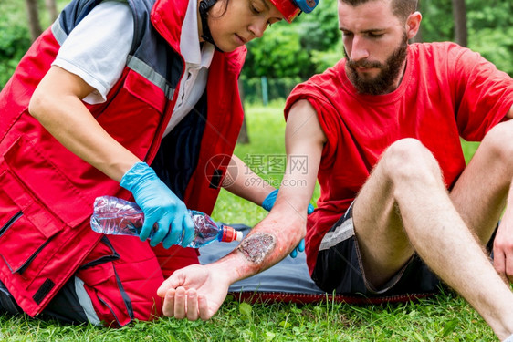 治疗男和rs手烧伤的医疗工作者户外急救治疗图片